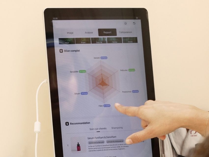 Échange personnalisé devant l’écran du trichoscope