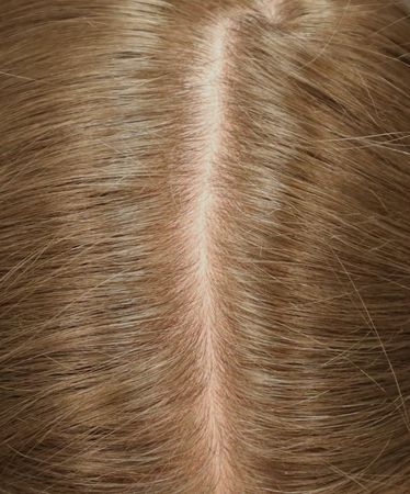 Cuir chevelu après 4 semaines d’utilisation régulière du Shampoing Purifiant & Rééquilibrant Démélé.