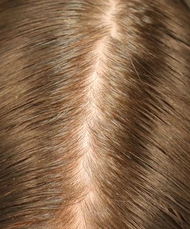 Cuir chevelu avant utilisation régulière du Shampoing Purifiant & Rééquilibrant Démélé.